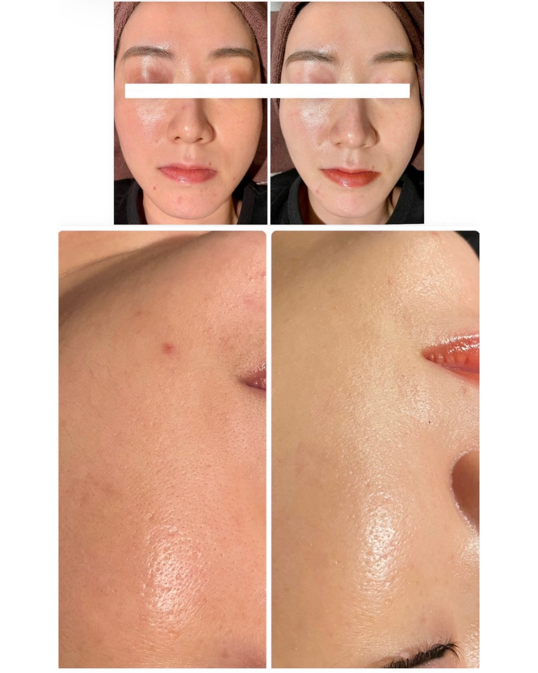 CHAGA TENSION AMPOULE SERUM