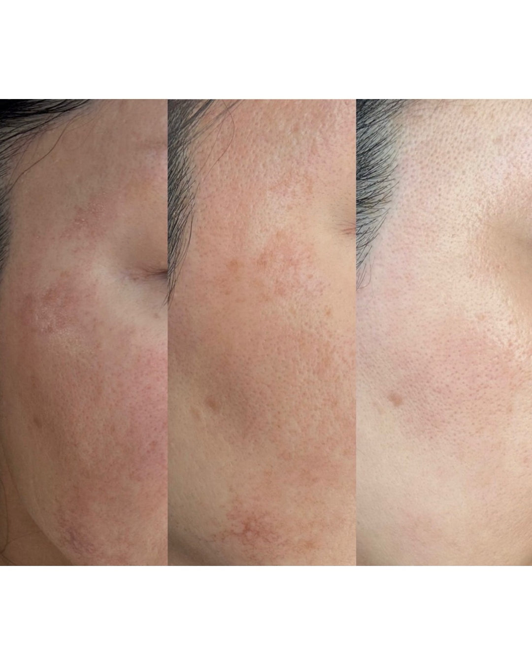 CHAGA TENSION AMPOULE SERUM